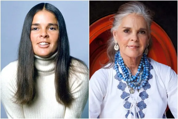 Ali MacGraw – Age 86