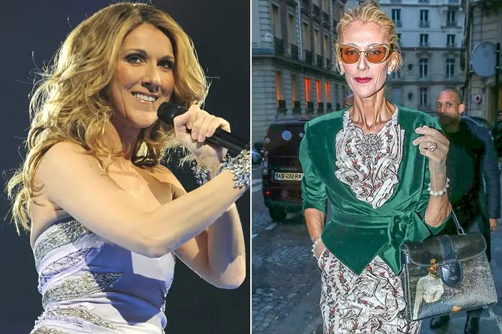Celine Dion – Weight Loss Undisclosed