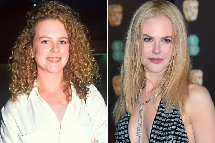 Nicole Kidman