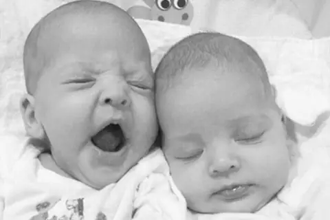 Ces jumelles conquièrent Instagram et le mannequinat grâce à leur beauté naturel