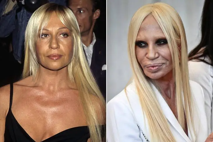 DONATELLA VERSACE (71) – REGGIO CALABRIA