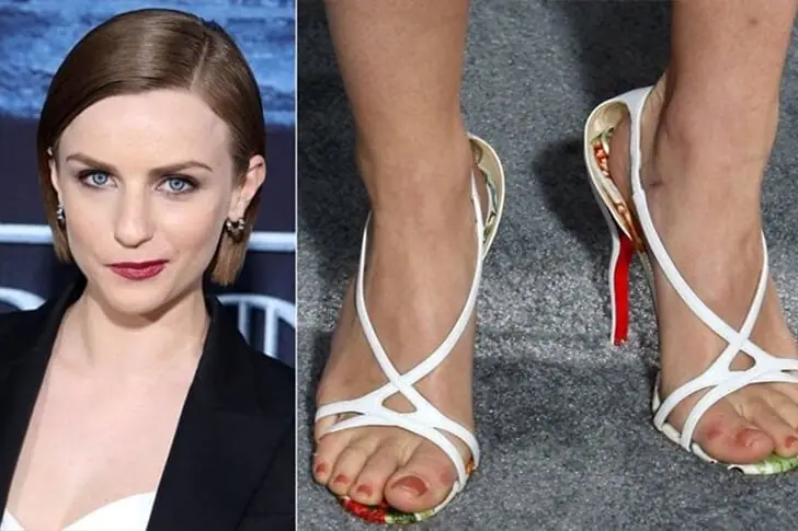 Faye Elaine Marsay’s Bruised Feet