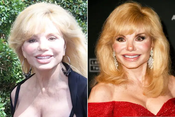 Loni Anderson (Born In 1945) – Minnesota