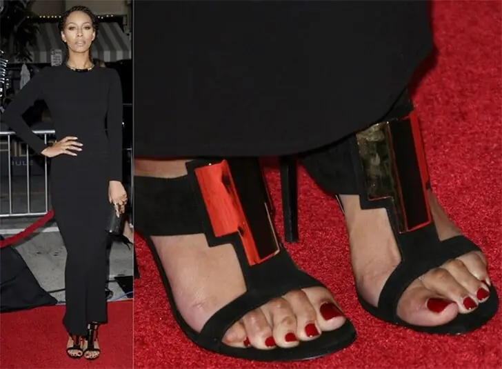 Keri Hilson’s Contracted Toes