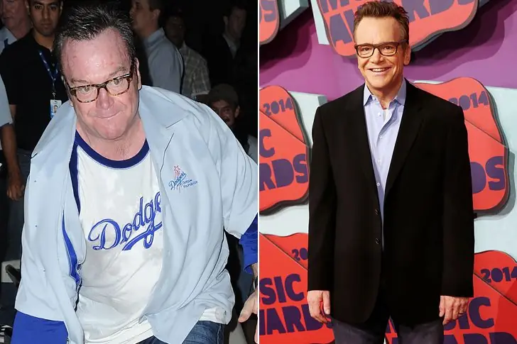 Tom Arnold – 64 years old (2022) – 100 Pounds Lost