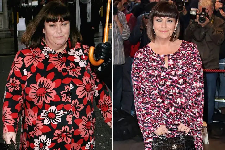 Dawn French – 65 years old – 92 Pounds Lost