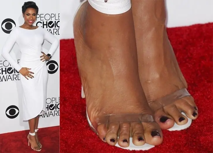 Jennifer Hudson’s Painful Feet