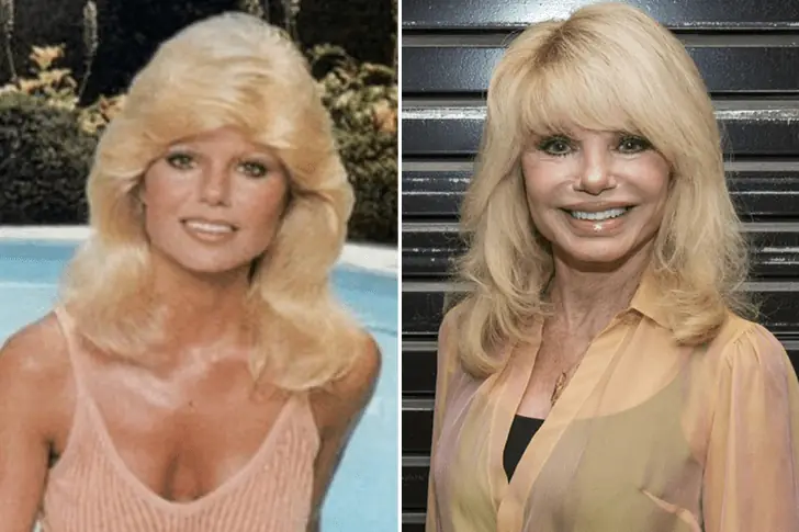 Loni Anderson – Age 79