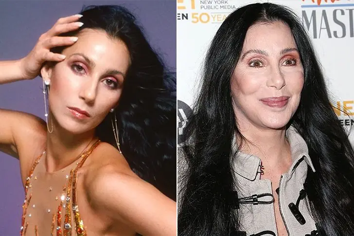 Cher – Age 78