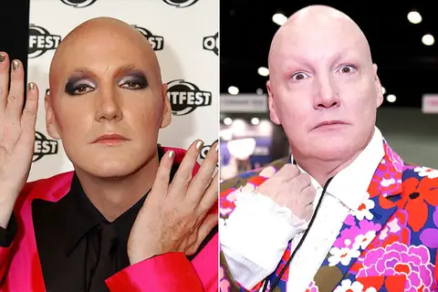 40+ Unbelievable Celebrity Transformations That Will Leave You Speechless!